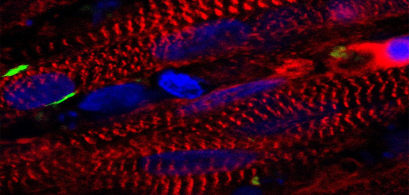 Engineers grow functioning human muscle from skin cells