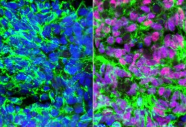 Scientists make cells that enable the sense of touch