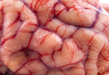 Fluoride Officially Classified As A Neurotoxin In World’s Top Medical Journals